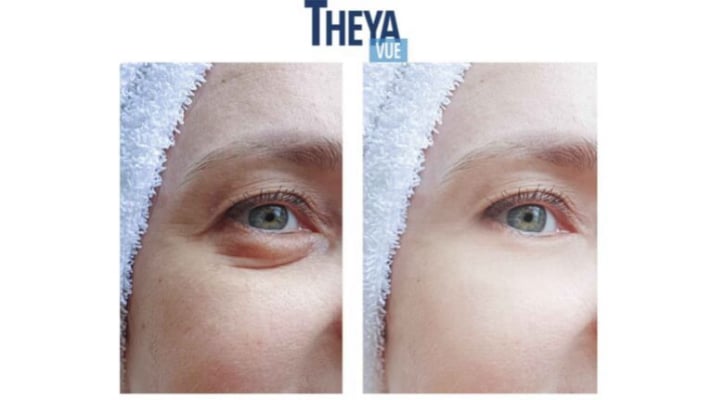 Woman with healthy eyes using natural vision support supplement